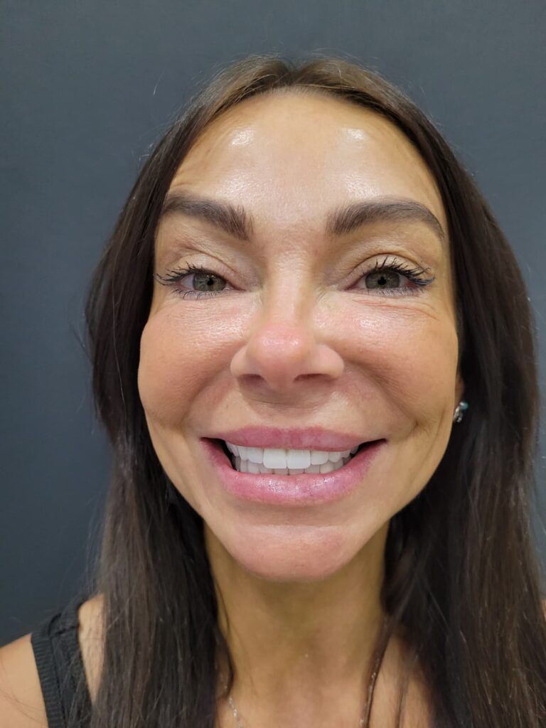 Dental Implants 3 1000636149