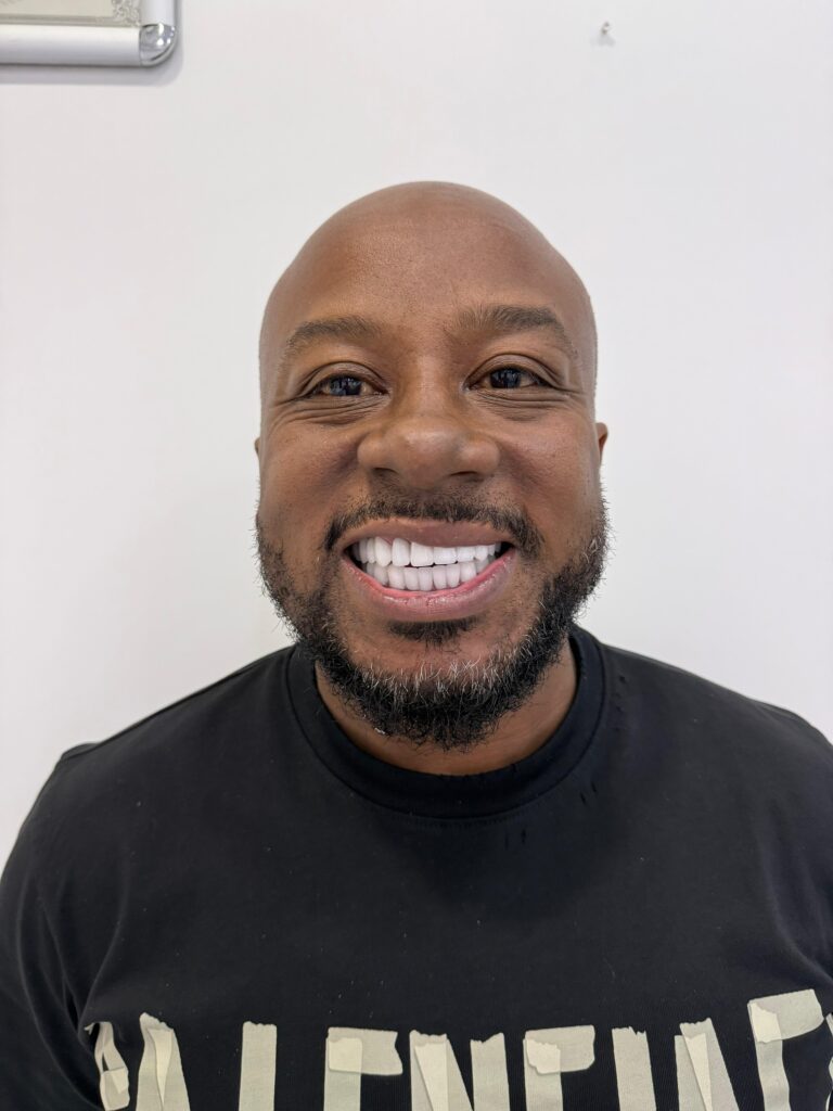Dental Implants 8 1000653696