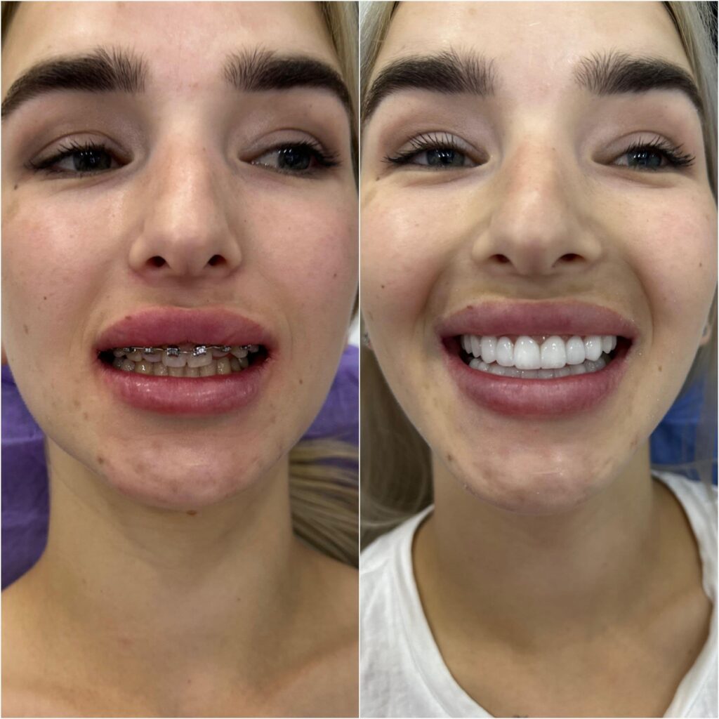 Dental Implants 6 1000730416