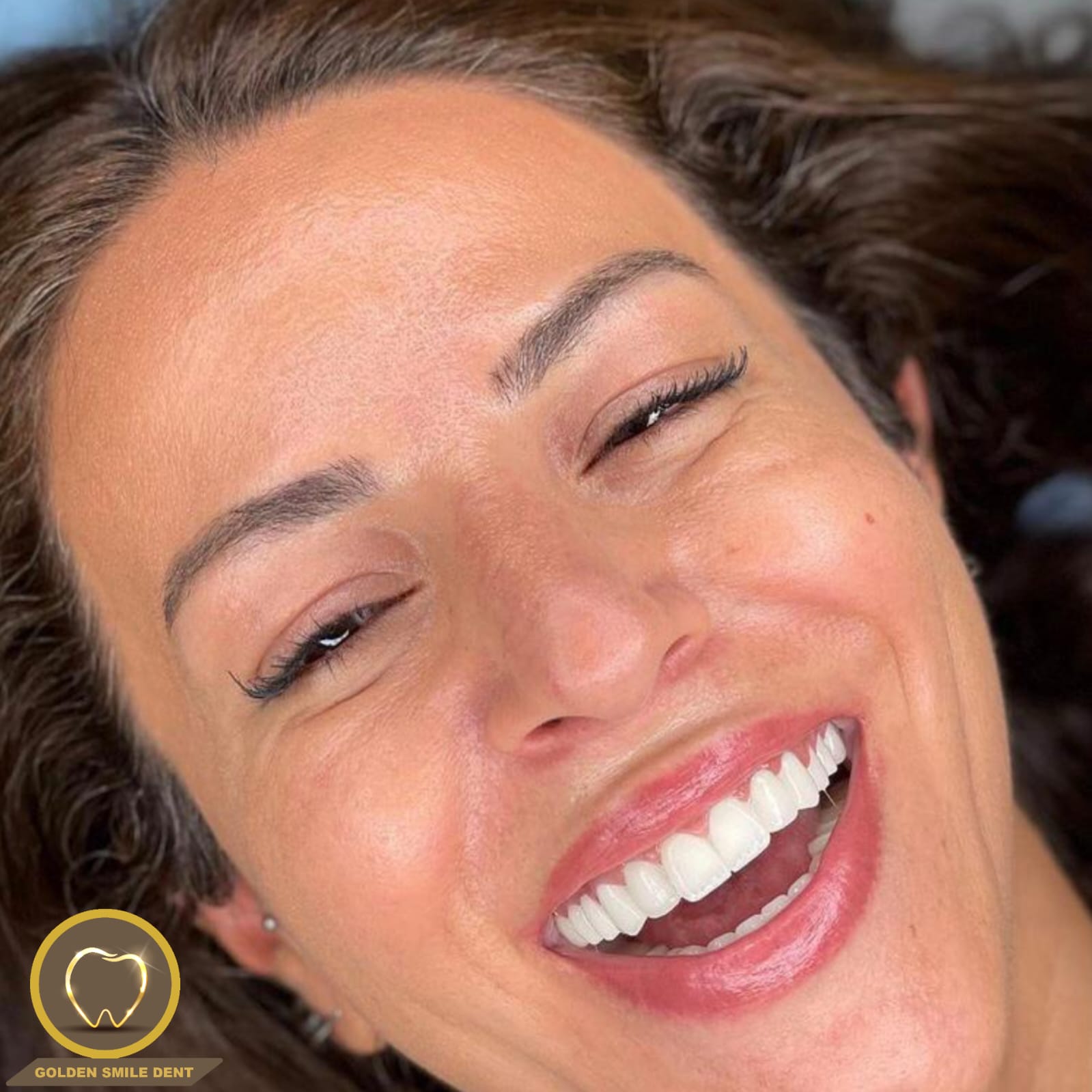 Dental Implant Turkey